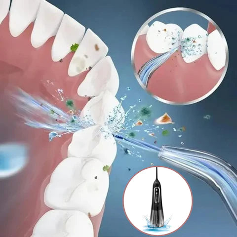 Irrigador Oral Portátil - OralJet